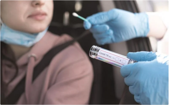 BRADESCO AMPLIA PRAZO PARA TESTAGEM DE COVID-19 img