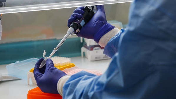 EMPREGADOS FARÃO TESTE SOROLÓGICO PARA COVID-19 img